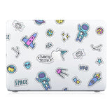 This lightweight, slim hardshell with 8 design is easy to install and fits closely to protect against scratches