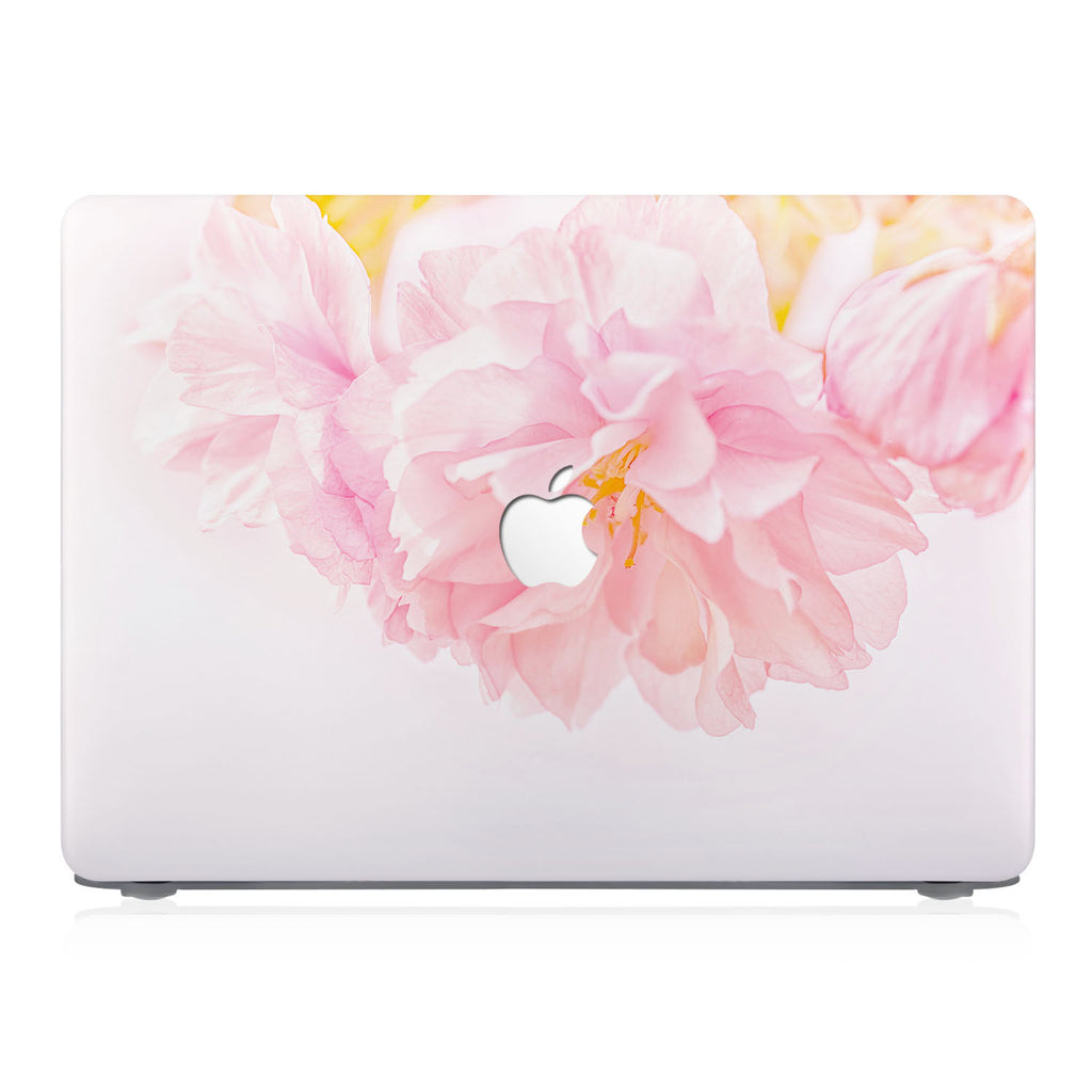 This lightweight, slim hardshell with 6 design is easy to install and fits closely to protect against scratches