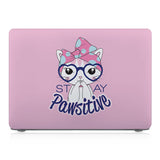 This lightweight, slim hardshell with 05 design is easy to install and fits closely to protect against scratches