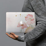 hardshell case with Abstract design combines a sleek hardshell design with vibrant colors for stylish protection against scratches, dents, and bumps for your Macbook