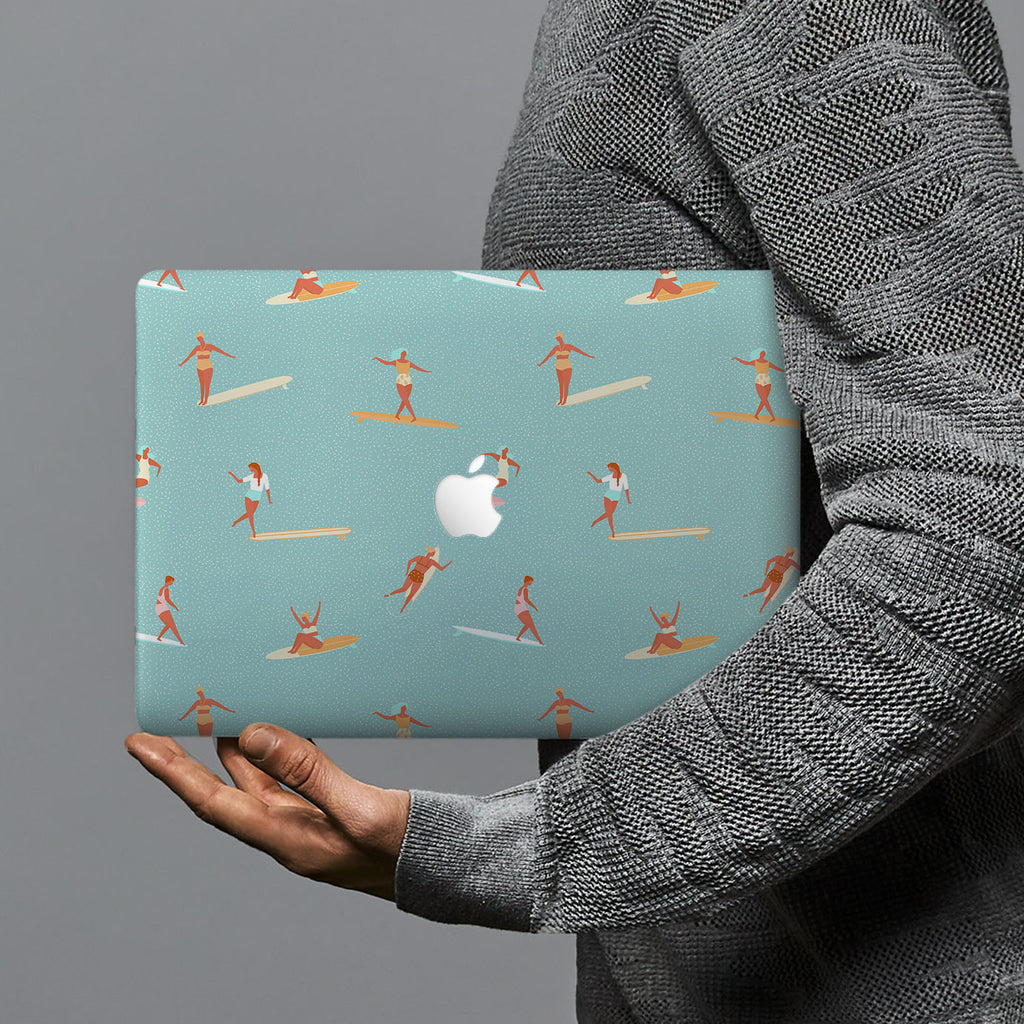 hardshell case with Summer design combines a sleek hardshell design with vibrant colors for stylish protection against scratches, dents, and bumps for your Macbook