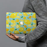 hardshell case with Fruit design combines a sleek hardshell design with vibrant colors for stylish protection against scratches, dents, and bumps for your Macbook